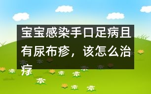 寶寶感染手口足病且有尿布疹，該怎么治療