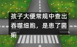 孩子大便常規(guī)中查出吞噬細胞，是患了菌痢